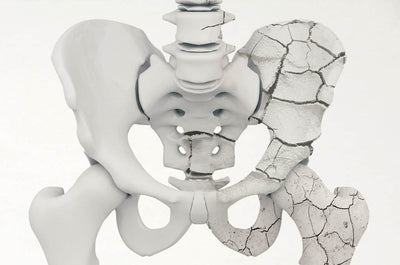 What Happens to Your Body When You Have Calcium Deficiency